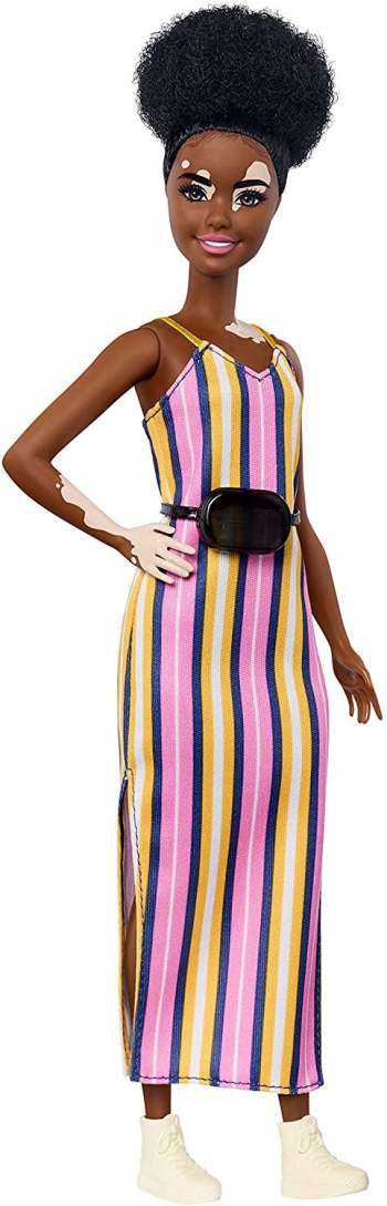 Barbie Fashionistas Doll with Vitiligo & Striped Dress